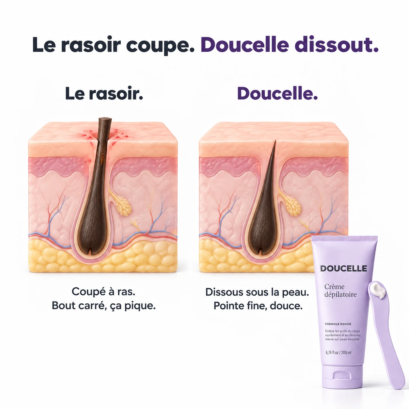 Le rasoir coupe le poil à ras, bout carré qui pique ; Doucelle le dissout sous la peau, pointe fine et douce