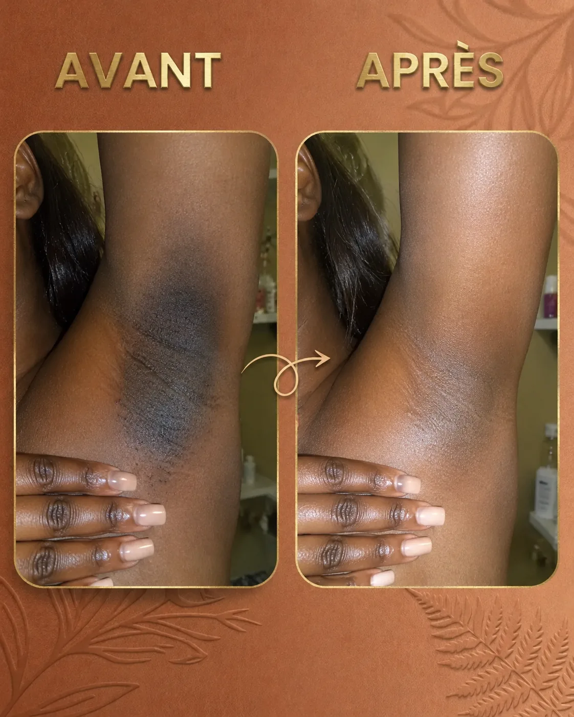 Avant apres Lumin'Or visage