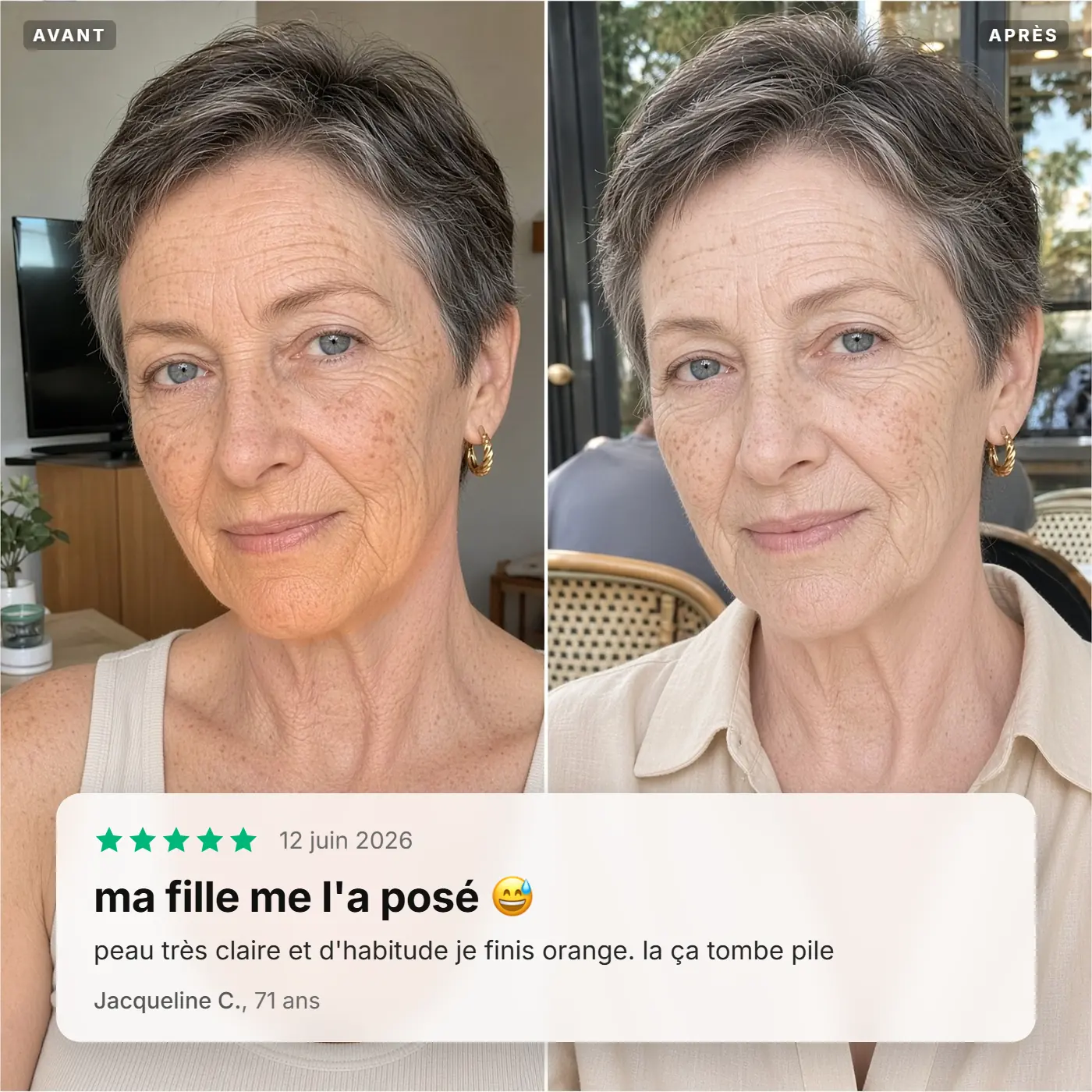 Avant / après de Jacqueline C., 71 ans : sa fille le lui a posé en trente secondes