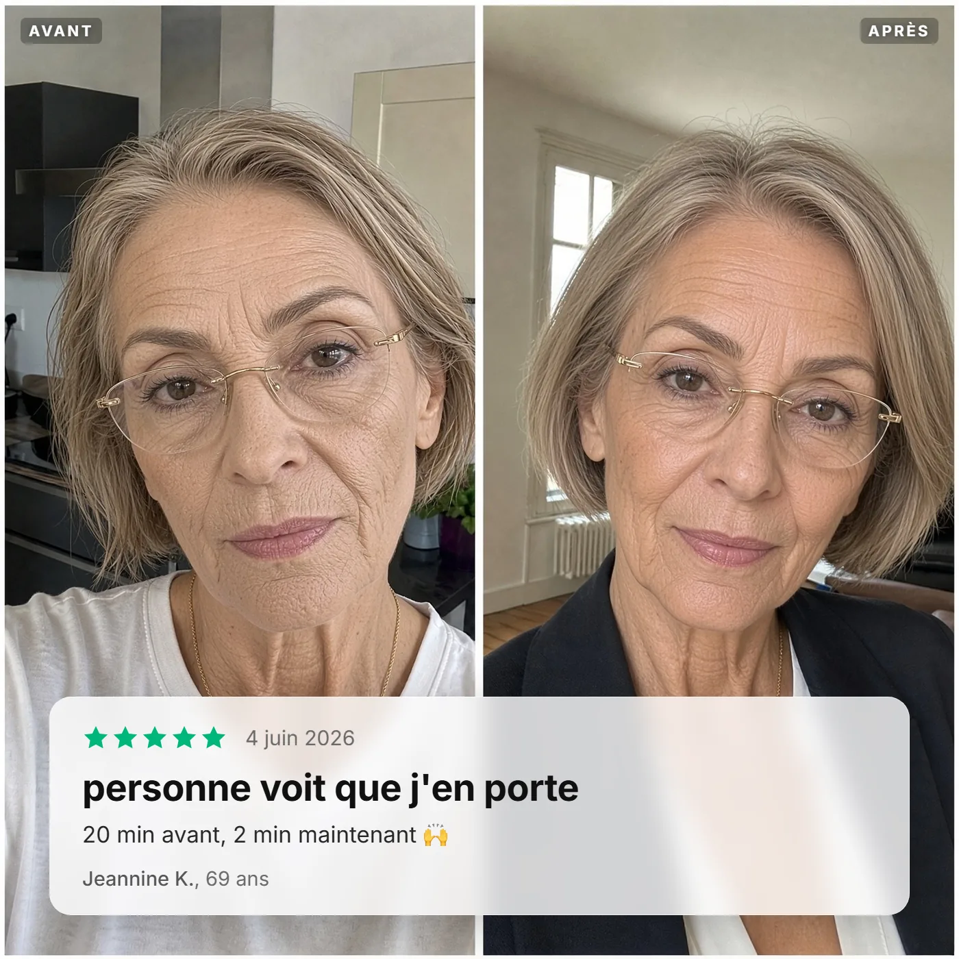 Avant / après de Jeannine K., 69 ans : personne ne voit que j'en porte