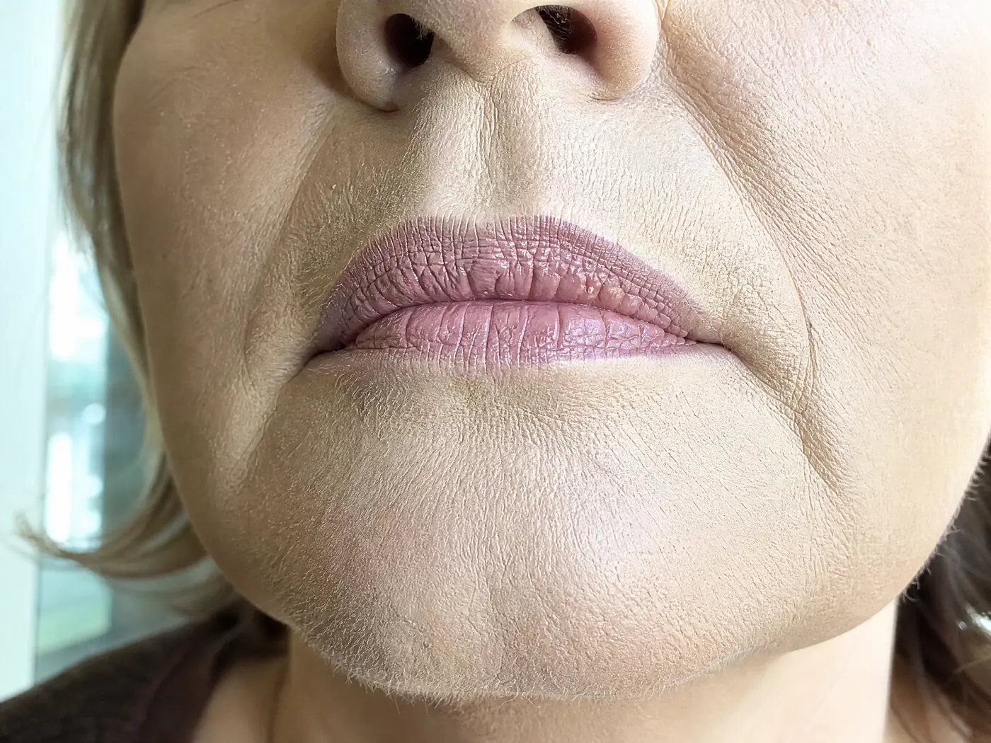 Gros plan&nbsp;: l'effet plâtre qui craquelle autour de la bouche